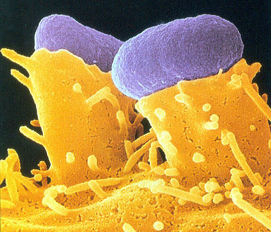 bacterial cells