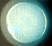 fertilized egg cell