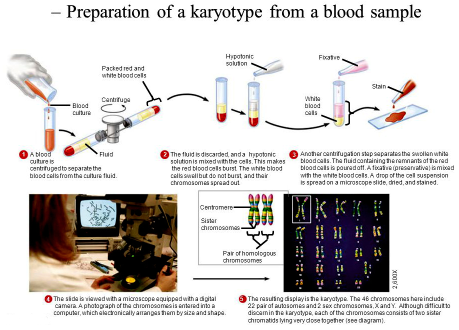 Human
                karyotye preparation