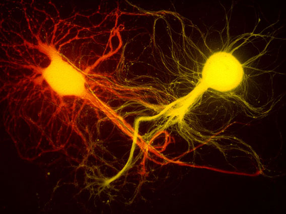 Aplaysia neurons