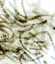 Nostoc - a cyanobacteria