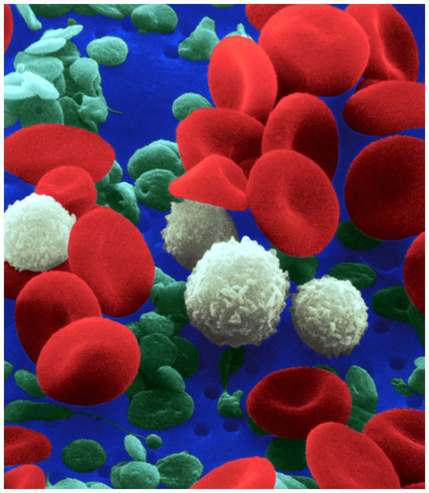 red-white blood cells